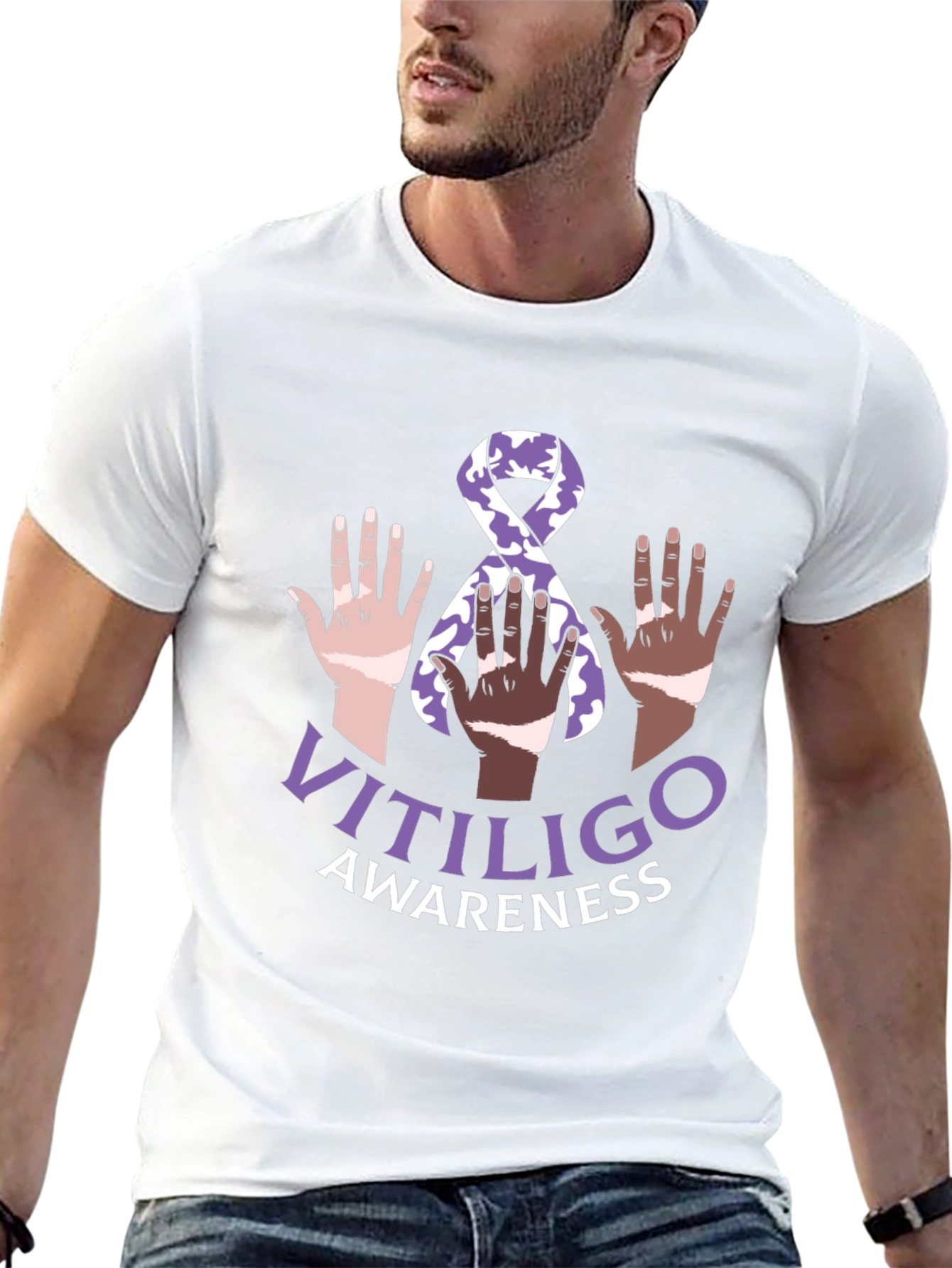 Vitiligo Awareness T-Shirt