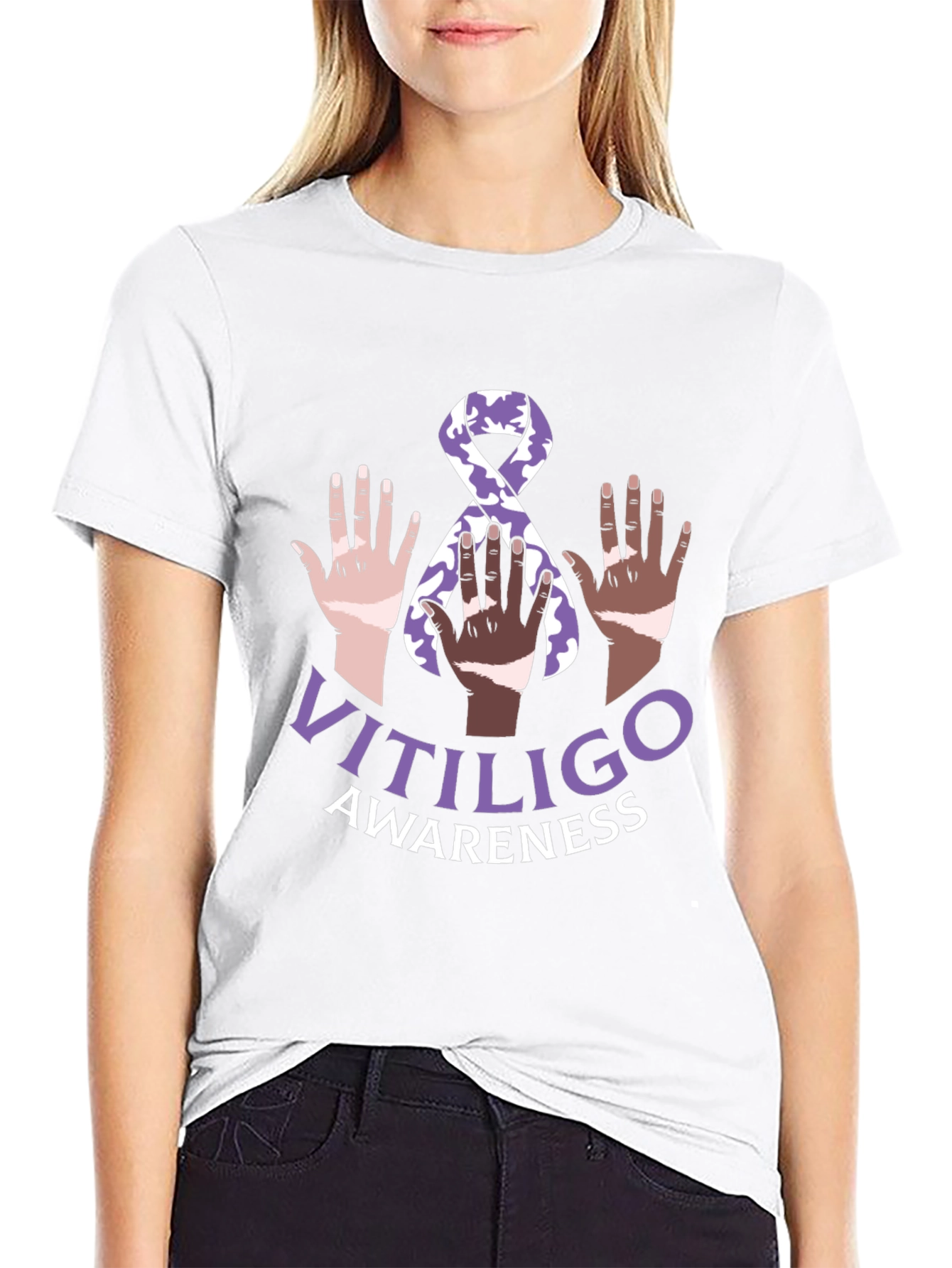 Vitiligo Awareness T-Shirt