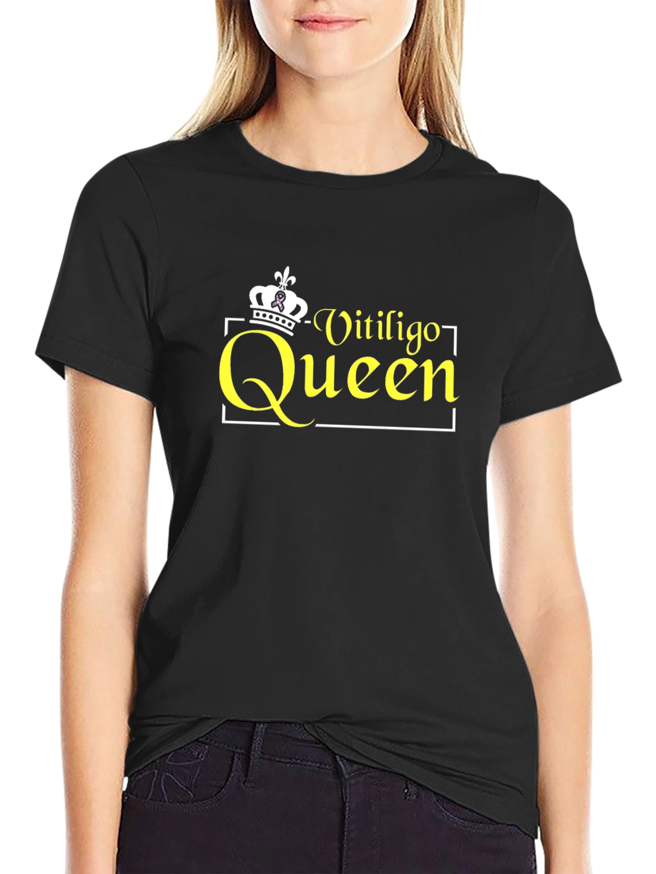 Vitiligo Queen Black T-Shirt