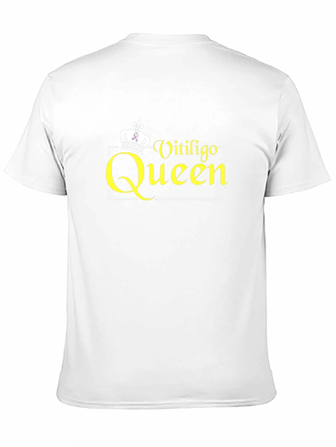 Vitiligo Queen Black T-Shirt