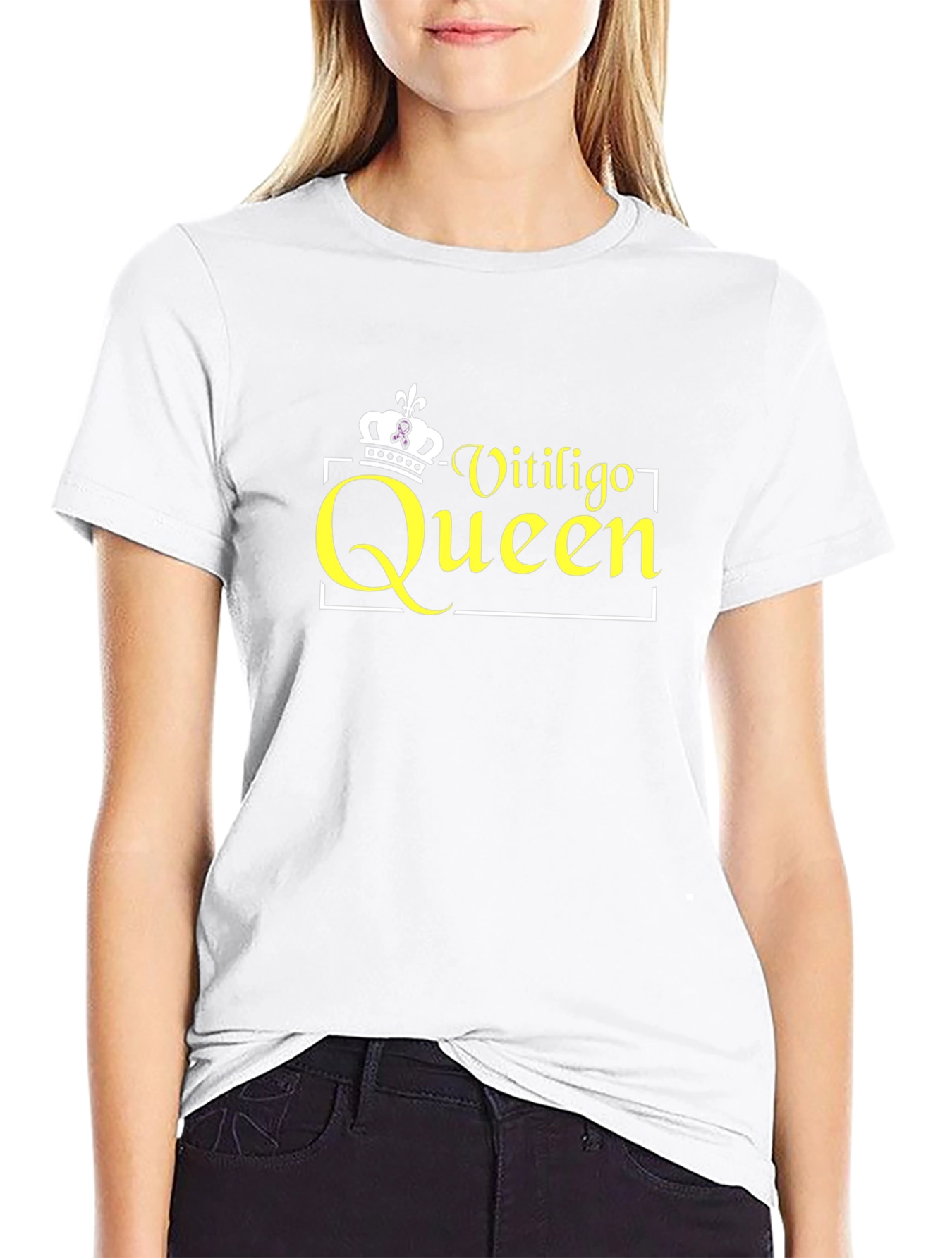 Vitiligo Queen Black T-Shirt