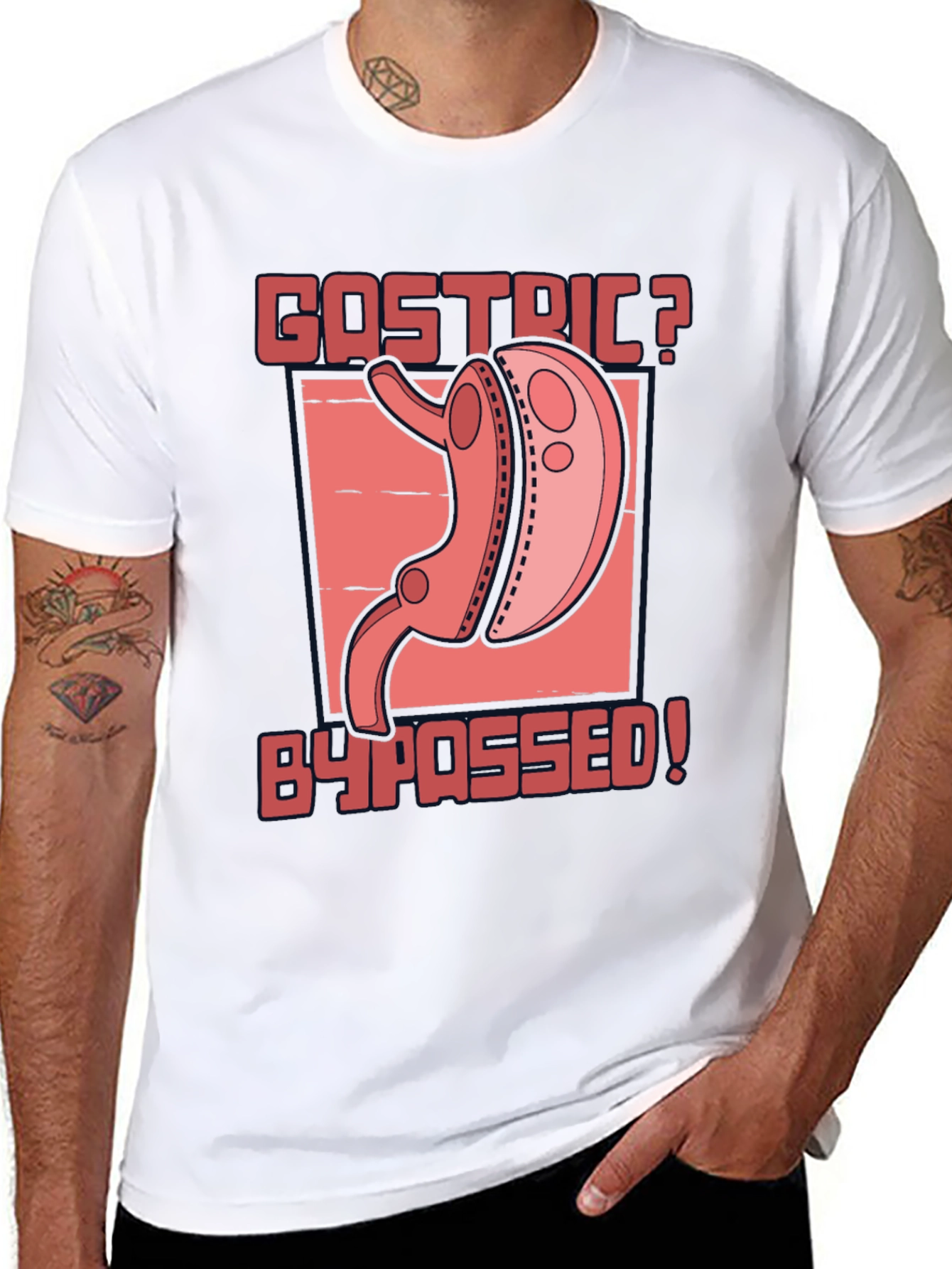 Gastric Bypassed Graphic T-Shirt